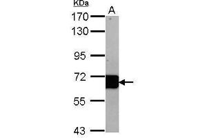 Western Blotting (WB) image for anti-Albumin (ALB) (C-Term) antibody (ABIN2855392)