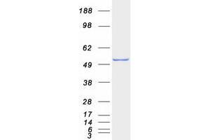 Western Blotting (WB) image for serine Hydroxymethyltransferase 1 (Soluble) (SHMT1) (Transcript Variant 1) protein (Myc-DYKDDDDK Tag) (ABIN2731999)