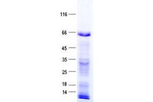 Western Blotting (WB) image for Zinc Finger Protein 37A (ZNF37A) protein (His tag) (ABIN2736028)
