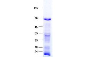 Validation with Western Blot (ZNF37A Protein (His tag))