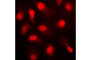 Immunofluorescence (IF) image for anti-Protein Kinase, AMP-Activated, alpha 1 Catalytic Subunit (PRKAA1) (C-Term), (pSer496) antibody (ABIN7299402)