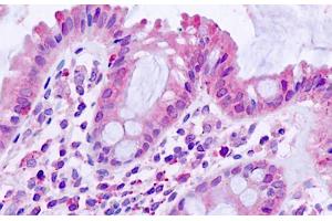 ABIN768623 (5µg/ml) staining of paraffin embedded Human Small Intestine. (TGFBR1 抗体  (AA 50-63))