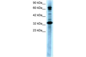 Western Blotting (WB) image for anti-TGF-beta Activated Kinase 1/MAP3K7 Binding Protein 2 (TAB2) antibody (ABIN2460457)