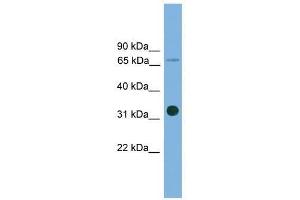 Western Blot showing SLC5A4 antibody used at a concentration of 1-2 ug/ml to detect its target protein. (SLC5A4 抗体  (Middle Region))