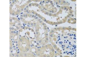 Immunohistochemistry of paraffin-embedded Mouse kidney using CHMP1B Polyclonal Antibody at dilution of 1:100 (40x lens). (CHMP1B 抗体)