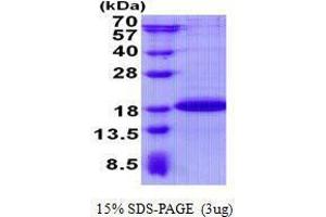 Figure annotation denotes ug of protein loaded and % gel used. (Sdhaf2 蛋白)