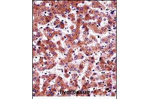 BP Antibody (N-term) (ABIN657686 and ABIN2846678) immunohistochemistry analysis in formalin fixed and paraffin embedded human liver tissue followed by peroxidase conjugation of the secondary antibody and DAB staining. (AMBP 抗体  (N-Term))