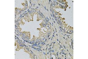 Immunohistochemistry of paraffin-embedded human prostate using LITAF Antibody (ABIN6130523, ABIN6143254, ABIN6143255 and ABIN6221131) at dilution of 1:100 (40x lens). (LITAF 抗体  (AA 1-161))