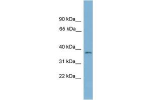 WB Suggested Anti-NUBP1 Antibody Titration: 0. (NUBP1 抗体  (Middle Region))
