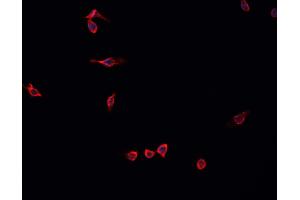 ABIN6268937 staining U-2 OS cells by IF/ICC. (MEF2C 抗体  (C-Term))