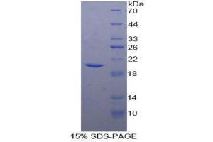 SDS-PAGE (SDS) image for TIMP Metallopeptidase Inhibitor 1 (TIMP1) (AA 32-207) protein (His tag) (ABIN1080955)