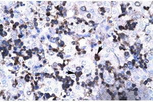Human Liver (FOXP3 抗体  (N-Term))