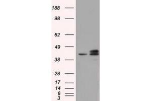 Image no. 2 for anti-Nucleoredoxin-Like 2 (NXNL2) antibody (ABIN1499887) (NXNL2 抗体)