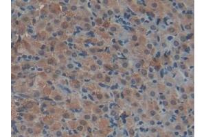 Detection of F2 in Rat Uterus Tissue using Polyclonal Antibody to Coagulation Factor II (F2) (Prothrombin 抗体  (AA 324-617))