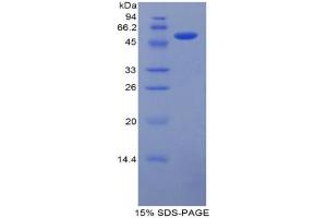 SDS-PAGE analysis of Mouse Laminin beta 1 Protein. (Laminin beta 1 蛋白)