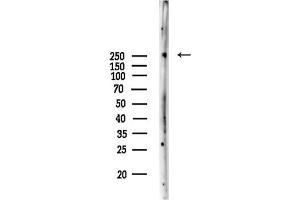 anti-Talin 2 (TLN2) (N-Term) antibody