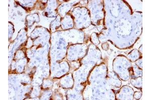 Formalin-fixed, paraffin-embedded human Placenta stained with PAPP-A Mouse Monoclonal Antibody (PAPPA/2715). (PAPPA 抗体  (AA 351-523))