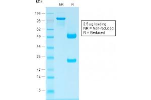 SDS-PAGE Analysis Purified IgG Rabbit Recombinant Monoclonal Antibody (IG1707R). (Recombinant IGHG 抗体)