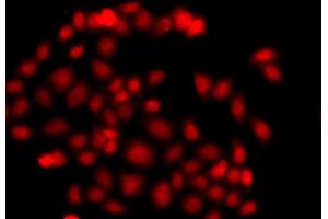 Immunofluorescence analysis of A549 cell using MLF1 antibody. (MLF1 抗体)