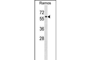 P4HA1 Antibody (C-term) (ABIN1537300 and ABIN2848732) western blot analysis in Ramos cell line lysates (35 μg/lane). (P4HA1 抗体  (C-Term))