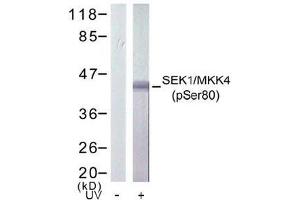 Image no. 2 for anti-Mitogen-Activated Protein Kinase Kinase 4 (MAP2K4) (pSer80) antibody (ABIN196911) (MAP2K4 抗体  (pSer80))