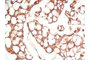 Mouse visceral fat tissue was stained by Rabbit Anti-Adiponutrin (436-481) (Human) Serum (PNPLA3 抗体  (AA 436-481))