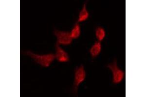 ABIN6274344 staining Hela by IF/ICC. (TDG 抗体  (Internal Region))
