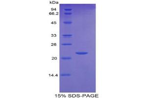 SDS-PAGE analysis of Mouse GCSFR Protein. (CSF3R 蛋白)