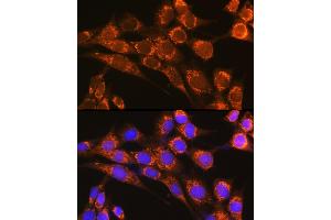 Immunofluorescence analysis of NIH-3T3 cells using CFP Rabbit pAb (ABIN6127651, ABIN6138467, ABIN6138468 and ABIN6221045) at dilution of 1:100 (40x lens). (CFP 抗体  (AA 190-469))
