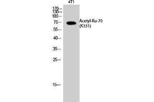 Western Blotting (WB) image for anti-X-Ray Repair Complementing Defective Repair in Chinese Hamster Cells 6 (XRCC6) (acLys331) antibody (ABIN3172846) (XRCC6 抗体  (acLys331))