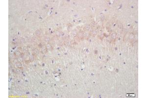 Formalin-fixed and paraffin embedded rat brain labeled with Rabbit Anti Annexin A13 Polyclonal Antibody, Unconjugated (ABIN671181) at 1:200 followed by conjugation to the secondary antibody and DAB staining (Aquaporin 4 抗体  (AA 271-323))