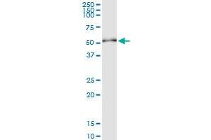 Immunoprecipitation of KRT20 transfected lysate using anti-KRT20 MaxPab rabbit polyclonal antibody and Protein A Magnetic Bead , and immunoblotted with KRT20 purified MaxPab mouse polyclonal antibody (B01P) . (KRT20 抗体  (AA 1-424))