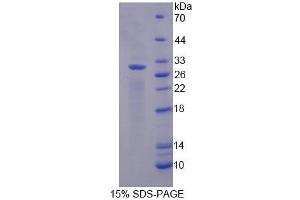 SDS-PAGE (SDS) image for Myoglobin (MB) protein (ABIN1877216) (Myoglobin Protein (MB))