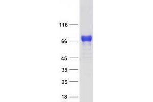 Western Blotting (WB) image for Promyelocytic Leukemia (PML) (Transcript Variant 5) protein (Myc-DYKDDDDK Tag) (ABIN2729209)