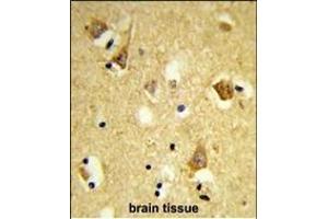 Immunohistochemistry (Paraffin-embedded Sections) (IHC (p)) image for anti-Apolipoprotein B mRNA Editing Enzyme, Catalytic Polypeptide-Like 3F (APOBEC3F) (AA 22-48), (N-Term) antibody (ABIN653123)