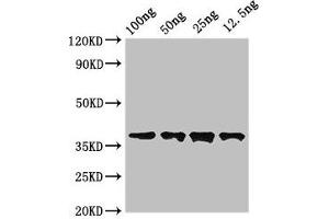 Western Blot Positive WB detected in Recombinant protein All lanes: DST antibody at 3. (Dystonin 抗体  (AA 1-195))