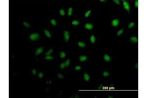 Immunofluorescence of purified MaxPab antibody to TTLL3 on HeLa cell. (TTLL3 抗体  (AA 1-101))