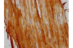 IHC image of ABIN7139708 diluted at 1:400 and staining in paraffin-embedded human skeletal muscle tissue performed on a Leica BondTM system. (Actin 抗体  (AA 7-377))