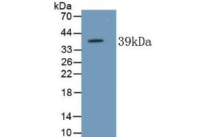 Detection of Recombinant ALPL, Human using Monoclonal Antibody to Alkaline Phosphatase, Tissue-nonspecific (ALPL) (ALPL 抗体  (AA 18-335))