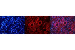 Rabbit Anti-HDAC6 Antibody   Formalin Fixed Paraffin Embedded Tissue: Human Kidney Tissue Observed Staining: Cytoplasm Primary Antibody Concentration: 1:100 Other Working Concentrations: N/A Secondary Antibody: Donkey anti-Rabbit-Cy3 Secondary Antibody Concentration: 1:200 Magnification: 20X Exposure Time: 0.
