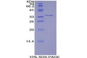 SDS-PAGE analysis of Human TRAF6 Protein. (TRAF6 蛋白)