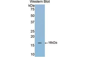 Western blot analysis of the recombinant protein. (COMP 抗体  (AA 40-180))