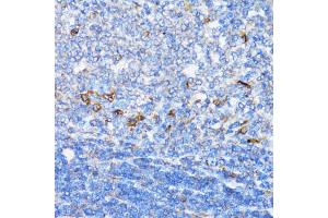 Immunohistochemistry of paraffin-embedded rat spleen using NDE1 antibody (ABIN5974277) at dilution of 1/100 (40x lens). (NDE1 抗体)