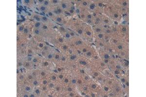 Used in DAB staining on fromalin fixed paraffin- embedded liver tissue (GTF2H5 抗体  (AA 1-71))