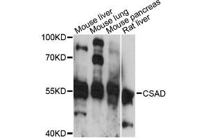 Western blot analysis of extracts of various cell lines, using CSAD antibody (ABIN6294199) at 1:3000 dilution. (CSAD 抗体)