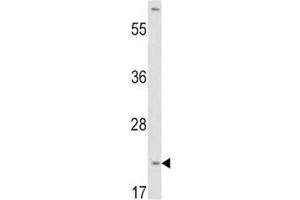 Western blot analysis of VHL antibody and HepG2 lysate. (VHL 抗体  (AA 43-71))