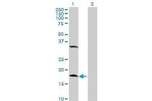 Western Blotting (WB) image for CETN2 293T Cell Transient Overexpression Lysate(Denatured) (ABIN1331330)