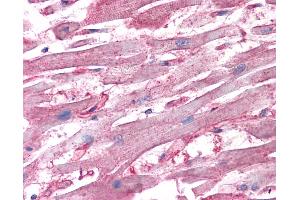 Immunohistochemistry (IHC) image for anti-ATPase, H+ Transporting, Lysosomal 34kDa, V1 Subunit D (ATP6V1D) (AA 69-169) antibody (ABIN574451)