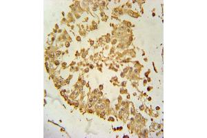 ZDHHC21 Antibody (N-term) (ABIN651365 and ABIN2840203) immunohistochemistry analysis in formalin fixed and paraffin embedded human testis tissue followed by peroxidase conjugation of the secondary antibody and DAB staining. (ZDHHC21 抗体  (N-Term))