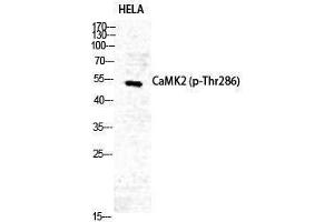 Western Blotting (WB) image for anti-CaMKIIalpha/delta (pThr286) antibody (ABIN3181941) (CaMKIIalpha/delta 抗体  (pThr286))